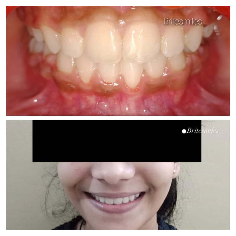 Orthodontics Case - After