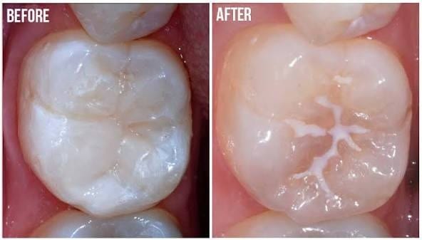 Preventive Care Case